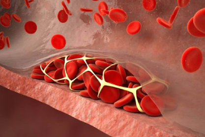 Treatment  for venous thromboembolism in children