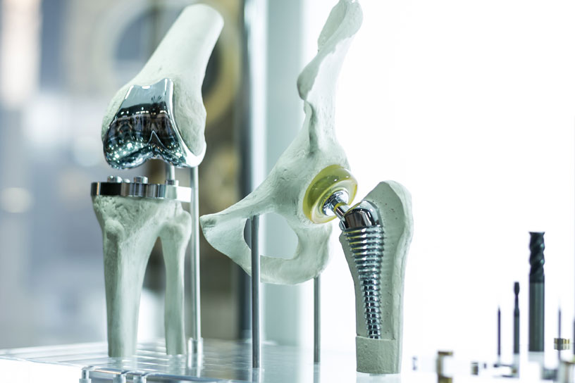 orthopedics-joints